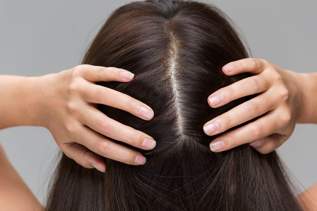 6 Common Types Of Scalp Problems And How To Treat Them